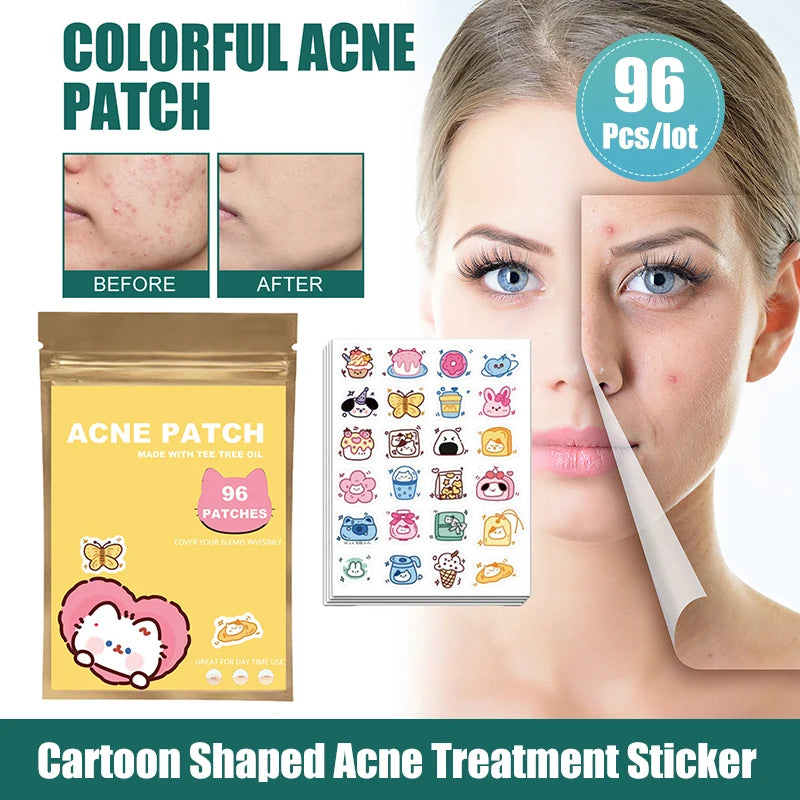 ClearCute Acne Patches – Cartoon Variety (96 Count)