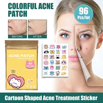 ClearCute Acne Patches – Cartoon Variety (96 Count)