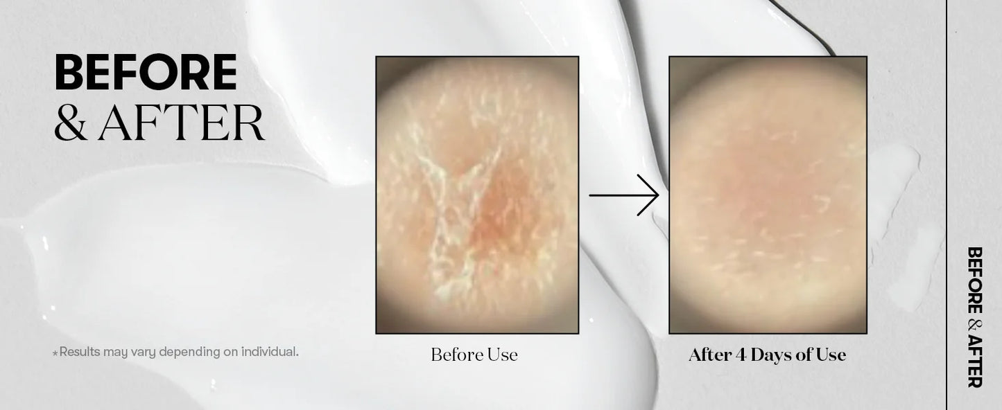 VT Cosmetics Korean Skincare Reedle Shot