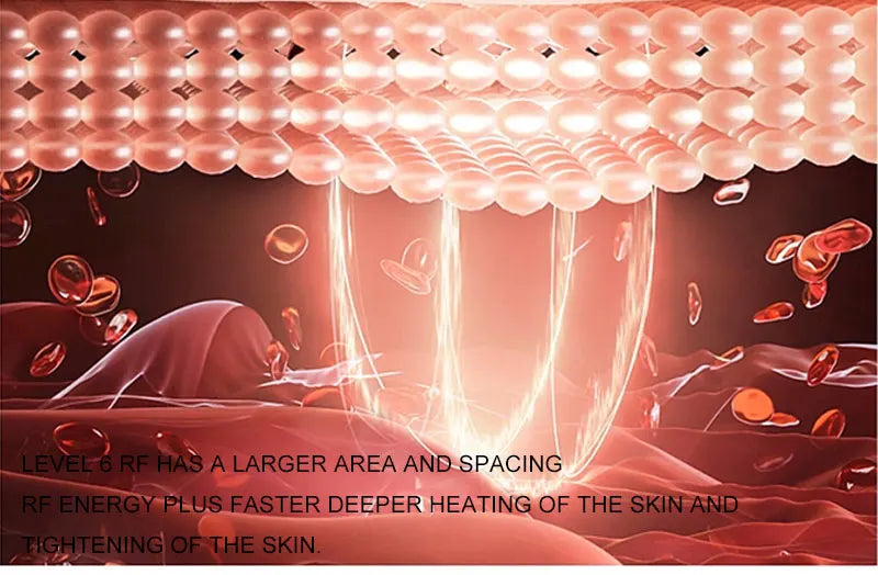 At-Home Skin Tightening & Face Lifting Device (RF + EMS)