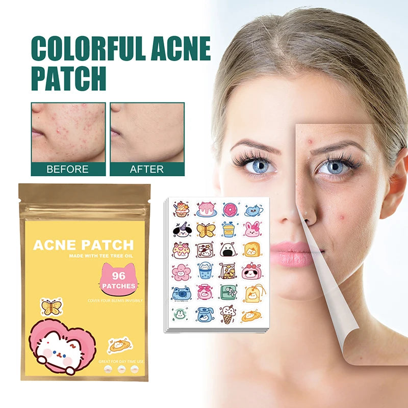 ClearCute Acne Patches – Cartoon Variety (96 Count)
