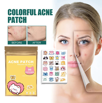 ClearCute Acne Patches – Cartoon Variety (96 Count)