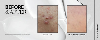 VT Cosmetics Korean Skincare Reedle Shot