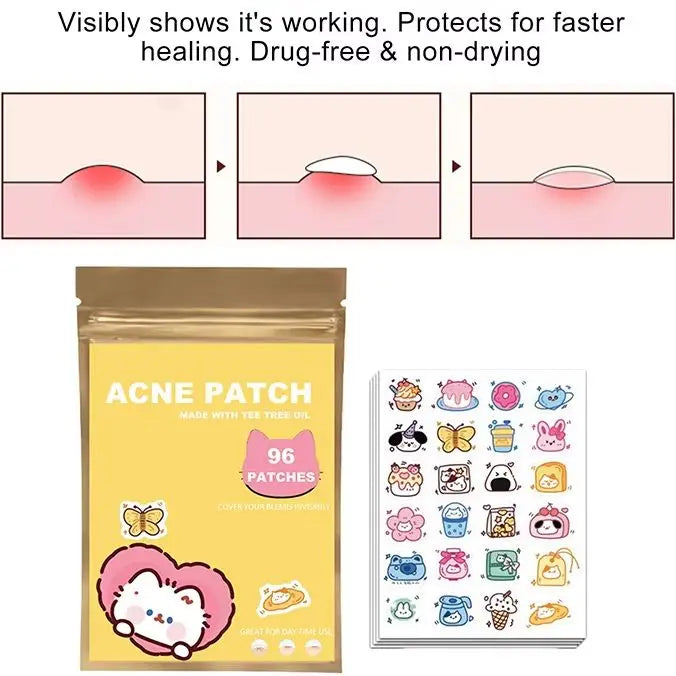 ClearCute Acne Patches – Cartoon Variety (96 Count)