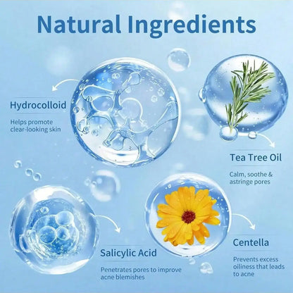 Kawaii Cat Clear Acne Patches (200-Pack)