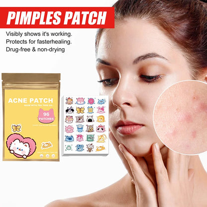 ClearCute Acne Patches – Cartoon Variety (96 Count)