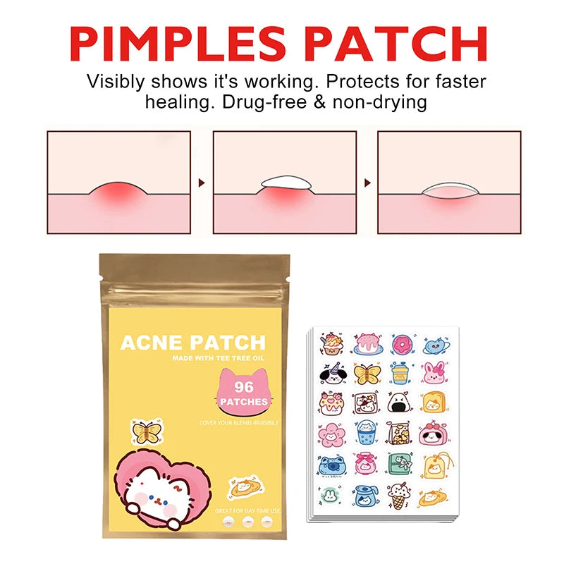 ClearCute Acne Patches – Cartoon Variety (96 Count)