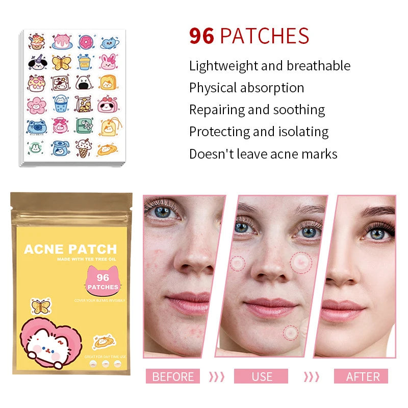 ClearCute Acne Patches – Cartoon Variety (96 Count)