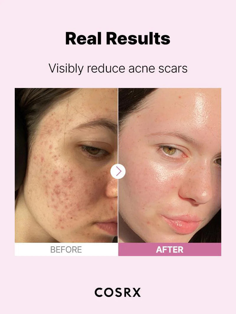 COSRX Korean Skincare The Niacinamide 15 Serum (20mL)